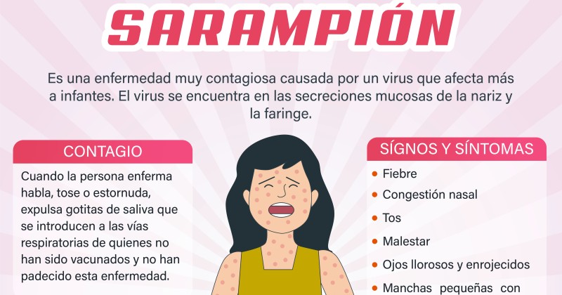 Comparte HNM información sobre síntomas de sarampión
