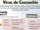 Importante tomar medidas preventivas contra virus de coxsackie: HNM